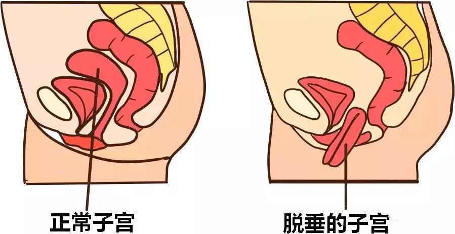 女性尿道周围的毛发，理解、护理与健康-第1张图片