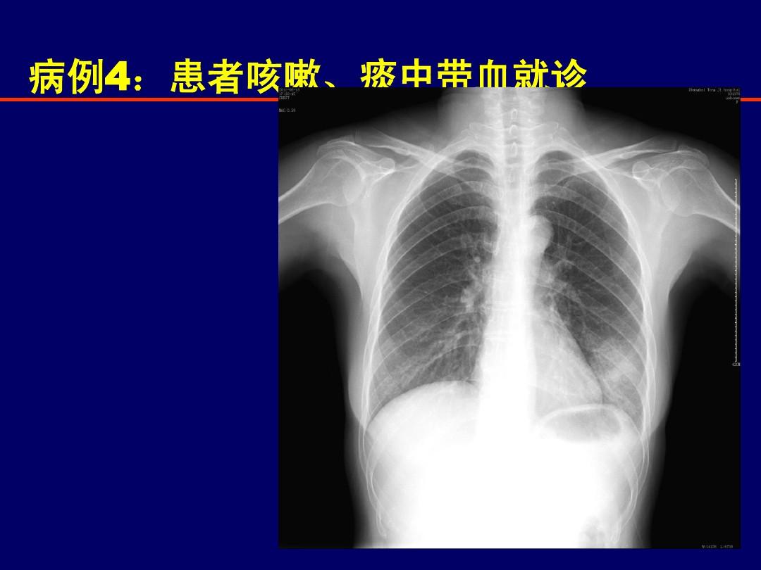 超大胸片曝光2025年超大胸片曝光，透视美丽背后的秘密-第2张图片