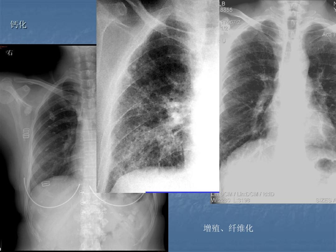 超大胸片曝光2025年超大胸片曝光，透视美丽背后的秘密-第3张图片