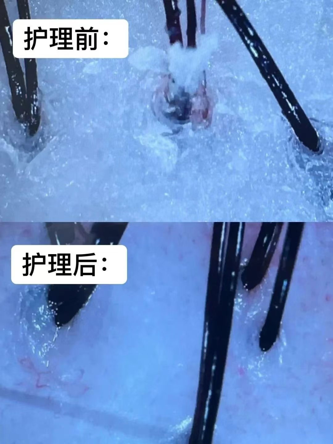 排毒传奇，让大爷的神奇之旅-第1张图片